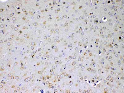 2 - Anti-IL15RA Picoband Antibody ABO13001