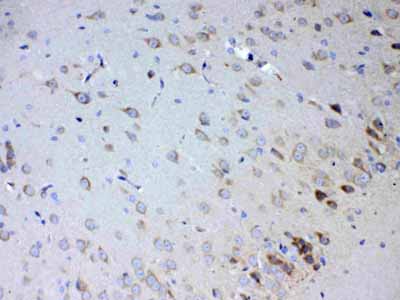 2 - Anti-IL15RA Picoband Antibody ABO13001