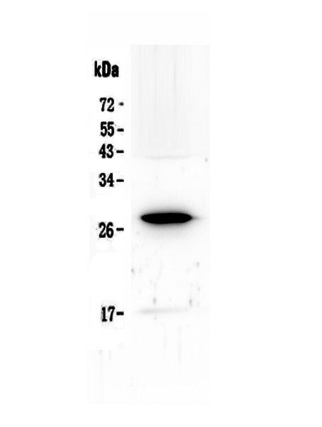 1 - Anti-IL15RA Picoband Antibody ABO13001
