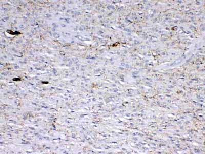 2 - Anti-GAD65 Picoband Antibody ABO13005