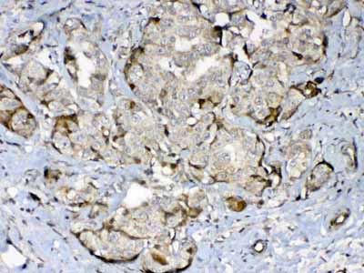 2 - Anti-GAD65 Picoband Antibody ABO13005