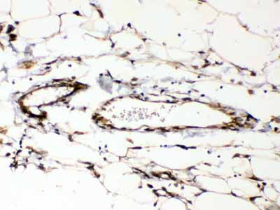 2 - Anti-Cyclophilin B Picoband Antibody ABO13007