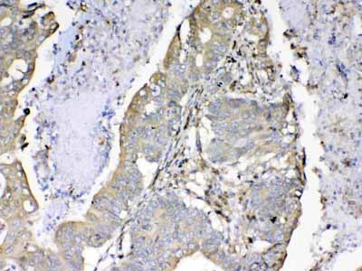 2 - Anti-Cyclophilin B Picoband Antibody ABO13007