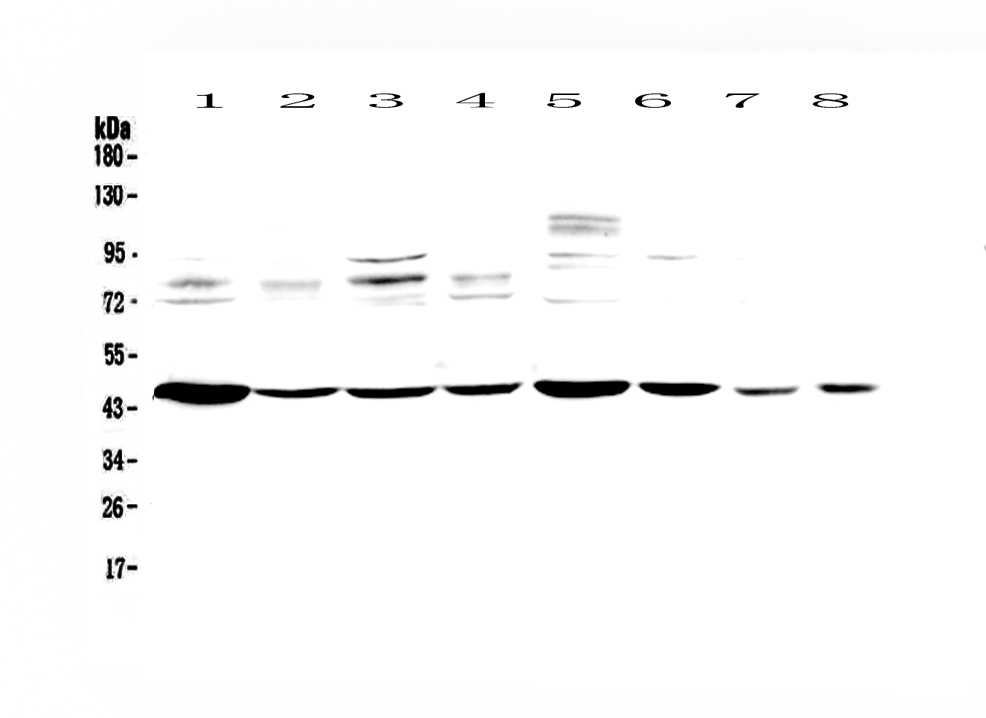 1 - Anti-PDK2 Picoband Antibody ABO13008