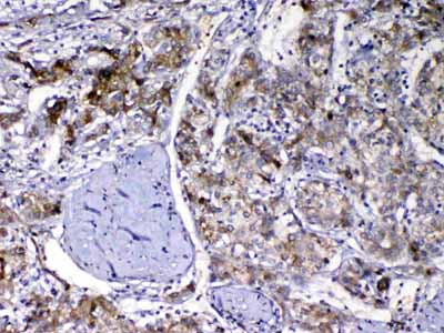 2 - Anti-Vitamin D Binding protein Picoband Antibody ABO13011