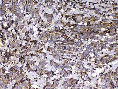 2 - Anti-Vitamin D Binding protein Picoband Antibody ABO13011