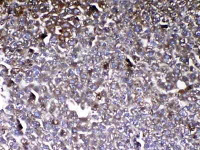 2 - Anti-Vitamin D Binding protein Picoband Antibody ABO13011