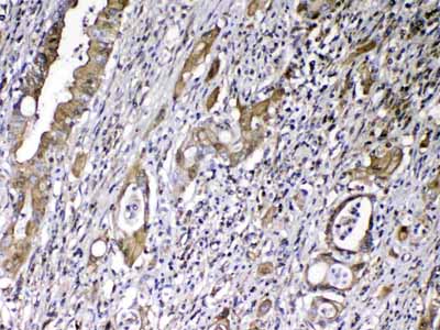 2 - Anti-Vitamin D Binding protein Picoband Antibody ABO13011