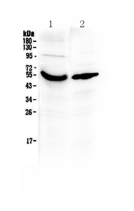 1 - Anti-Vitamin D Binding protein Picoband Antibody ABO13011