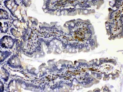 2 - Anti-Calpain 2 Picoband Antibody ABO13013