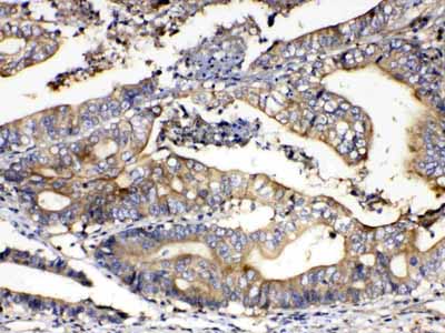 2 - Anti-Calpain 2 Picoband Antibody ABO13013