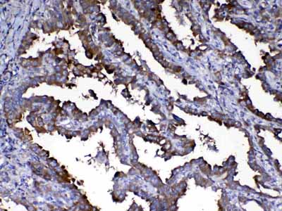 2 - Anti-Calpain 2 Picoband Antibody ABO13013