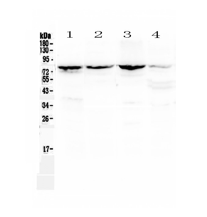1 - Anti-Calpain 2 Picoband Antibody ABO13013