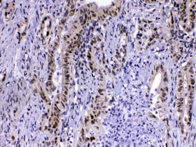 2 - Anti-MED15 Picoband Antibody ABO13018