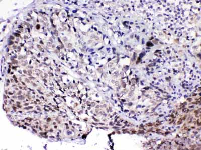 2 - Anti-MED15 Picoband Antibody ABO13018