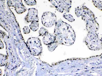2 - Anti-MED15 Picoband Antibody ABO13018