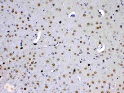 2 - Anti-MED15 Picoband Antibody ABO13018