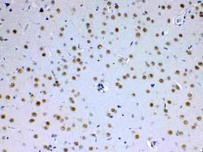 2 - Anti-MED15 Picoband Antibody ABO13018