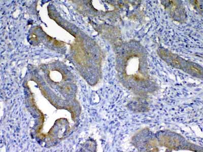 2 - Anti-MMP10 Picoband Antibody ABO13020