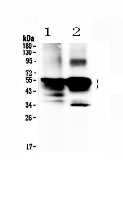 1 - Anti-Retinal S antigen Picoband Antibody ABO13021