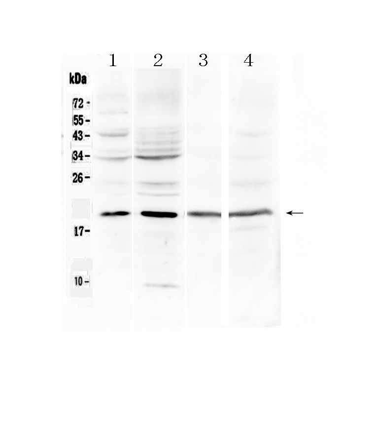 1 - Anti-Myoglobin Picoband Antibody ABO13025