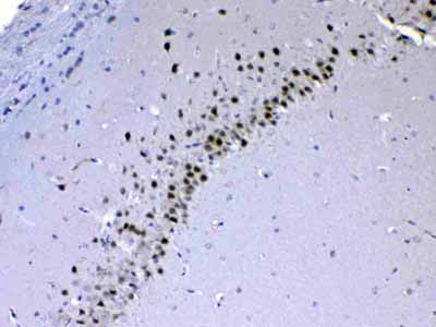 2 - Anti-CHD2 Antibody ABO13026