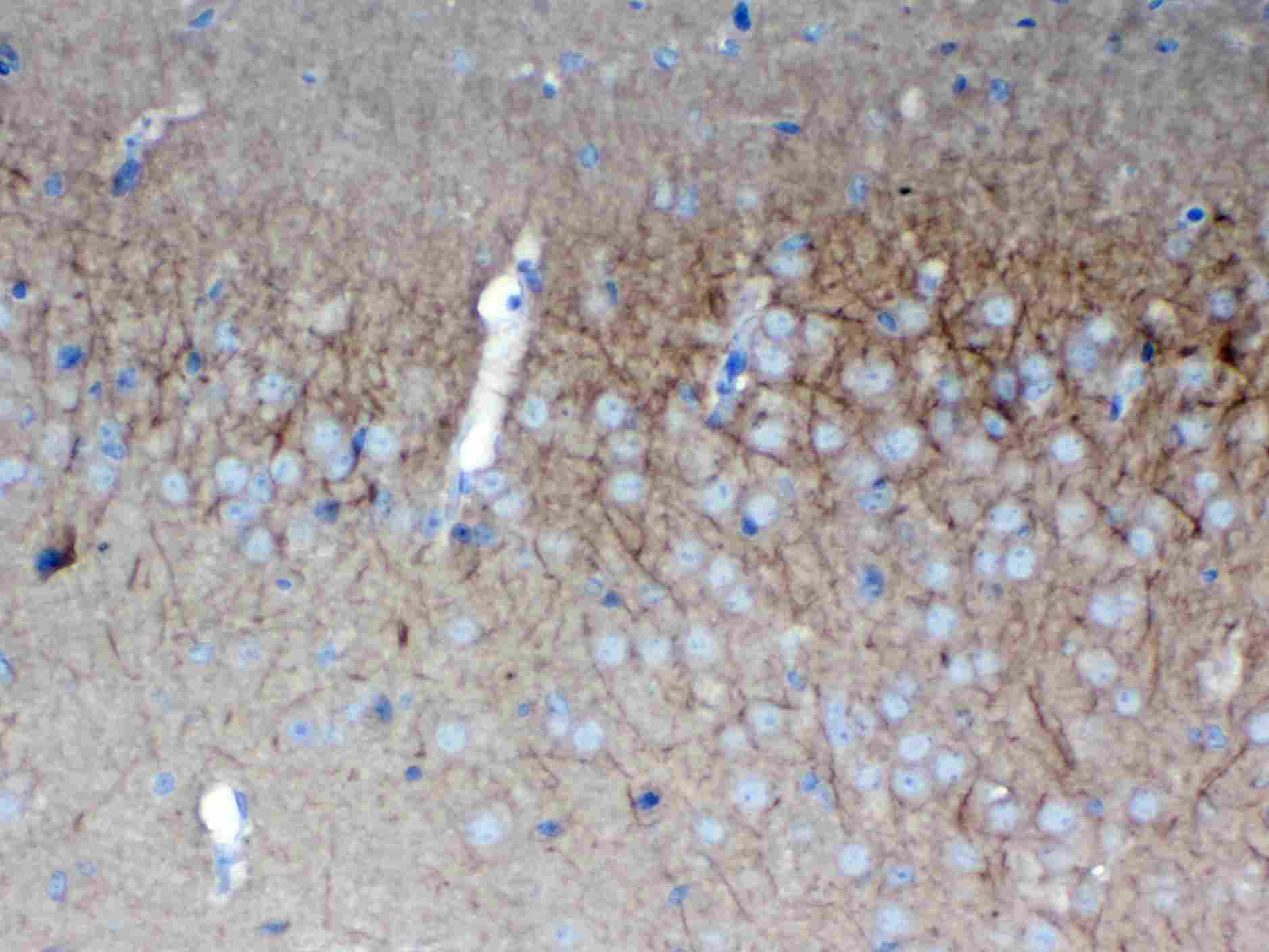 2 - Anti-SAP102 Picoband Antibody ABO13027