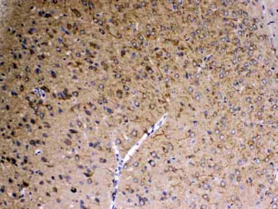 2 - Anti-SAP102 Picoband Antibody ABO13027