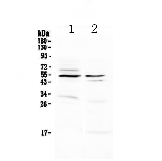 1 - Anti-VIP Receptor 1 Picoband Antibody ABO13028