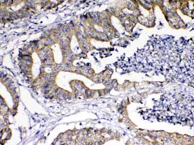 2 - Anti-TNFSF18 Picoband Antibody ABO13029