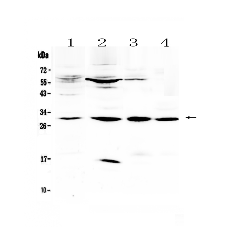 1 - Anti-VEGFB Picoband Antibody ABO13031