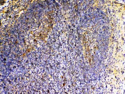 2 - Anti-VEGFB Picoband Antibody ABO13032