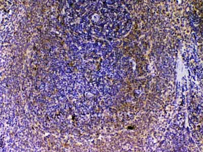 2 - Anti-VEGFB Picoband Antibody ABO13032