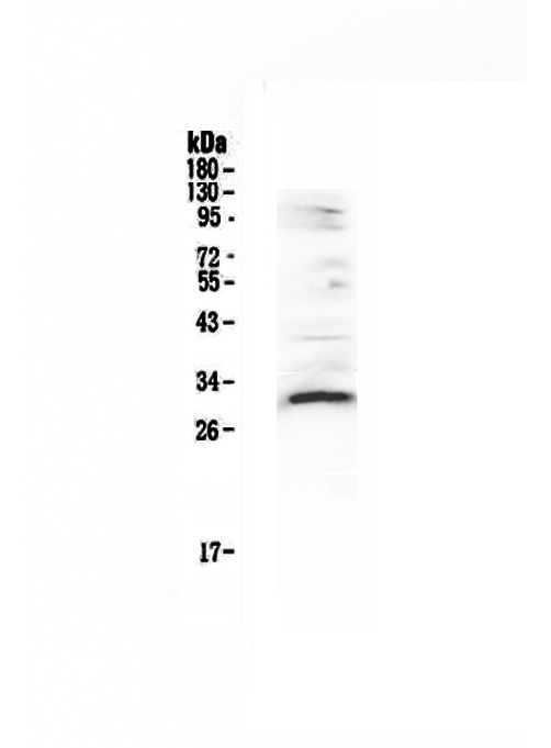 1 - Anti-VEGFB Picoband Antibody ABO13032