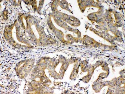 2 - Anti-FZD3 antibody ABO13035
