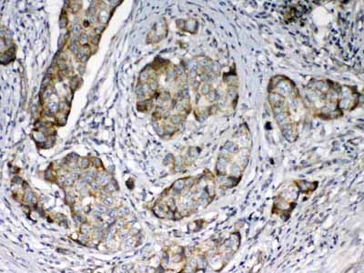 2 - Anti-FZD3 antibody ABO13035