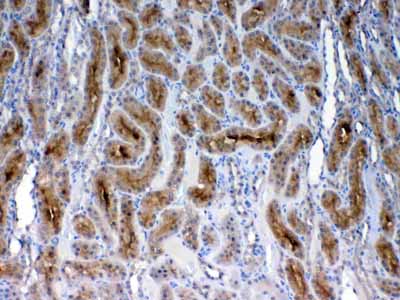 2 - Anti-FZD3 antibody ABO13035