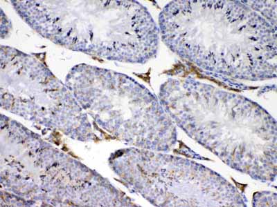 2 - Anti-CP110 Picoband Antibody ABO13042