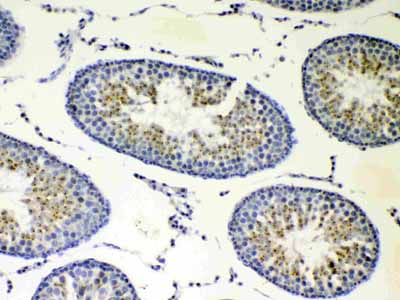 2 - Anti-CP110 Picoband Antibody ABO13042