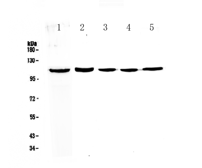 1 - Anti-CP110 Picoband Antibody ABO13042