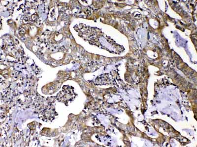 2 - Anti-MMP16 Picoband Antibody ABO13043