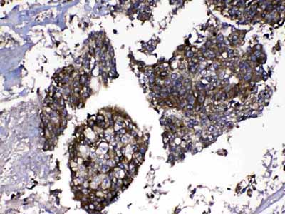 2 - Anti-MMP16 Picoband Antibody ABO13043