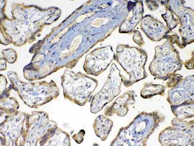 2 - Anti-MMP16 Picoband Antibody ABO13043