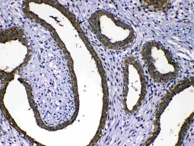 2 - Anti-MMP16 Picoband Antibody ABO13043