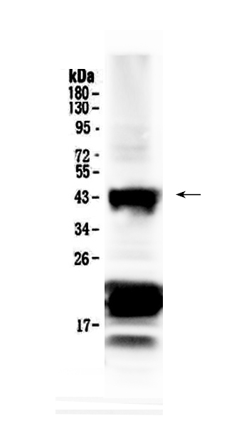 1 - Anti-CHX10 Picoband Antibody ABO13045