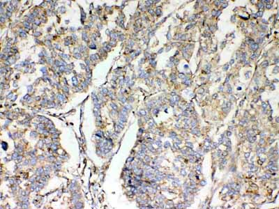 2 - Anti-TSPAN12 Picoband Antibody ABO13046
