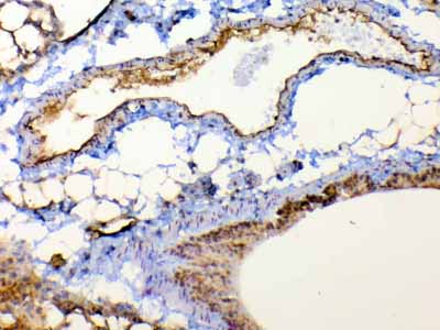 2 - Anti-TSPAN12 Picoband Antibody ABO13046