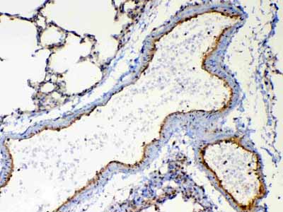 2 - Anti-TSPAN12 Picoband Antibody ABO13046