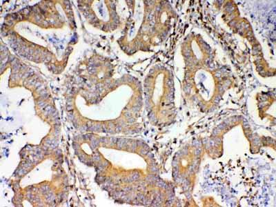 2 - Anti-TSPAN12 Picoband Antibody ABO13046