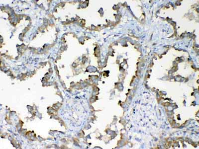 2 - Anti-DYNLT1 Picoband Antibody ABO13047